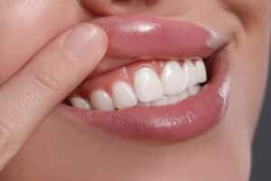 Woman lifts her lips to show off healthy, pink gums.